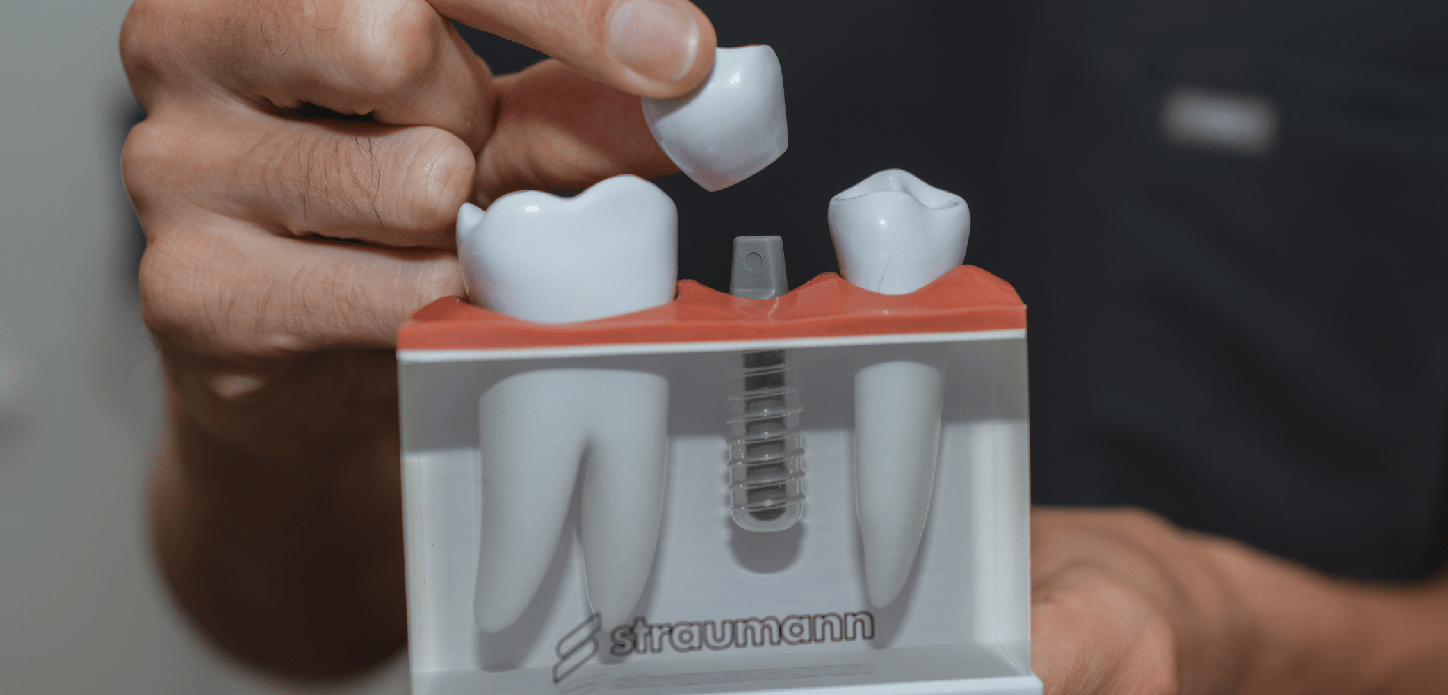 Missing a tooth?