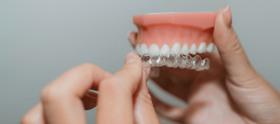 Invisalign