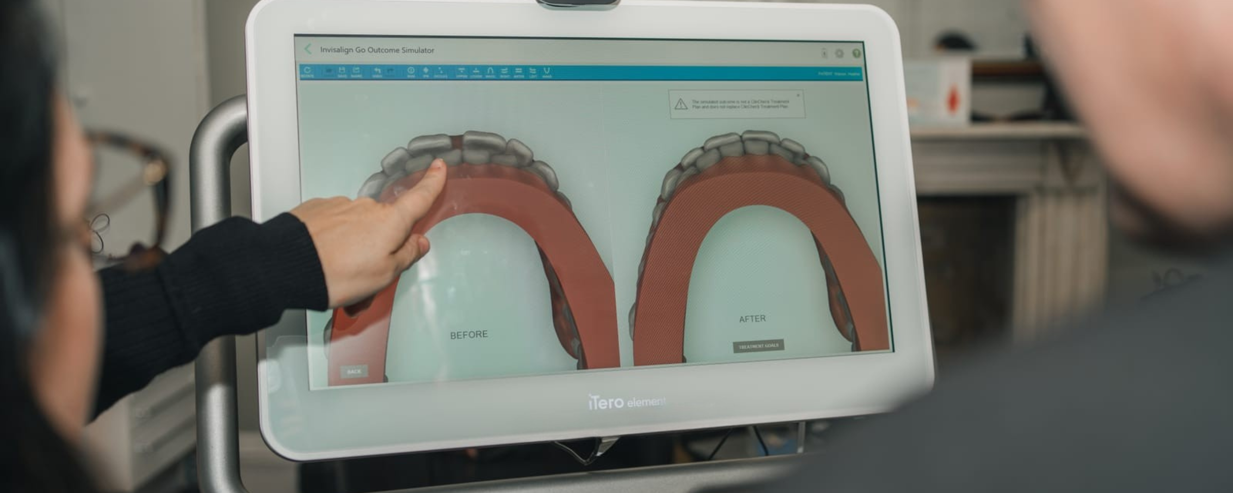 Invisalign Clear Aligners in Clowne, near Chesterfield