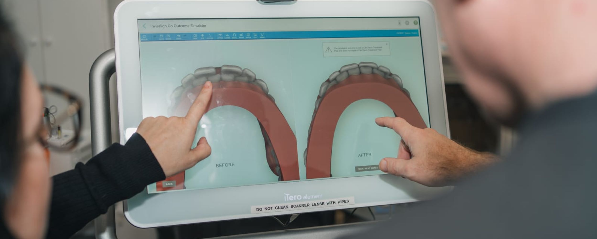 Invisalign Clear Aligners in Clowne, near Chesterfield